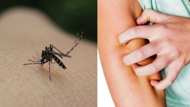 Το φυσικό εντομοαπωθητικό των 2 υλικών που θα εξαφανίσει τα κουνούπια στο λεπτό