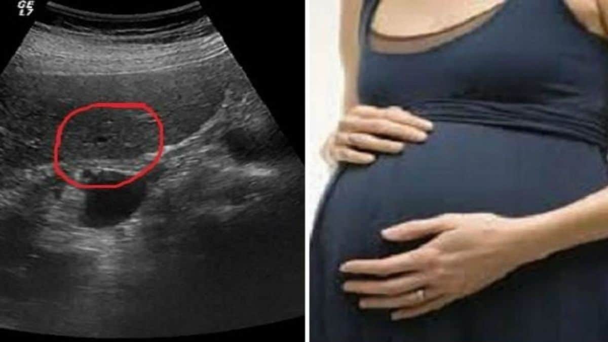 29χρονη πίστευε πως ήταν έγκυος και πήγε στο γιατρό – Μόλις άκουσε την διάγνωση της κόπηκαν τα γόνατα
