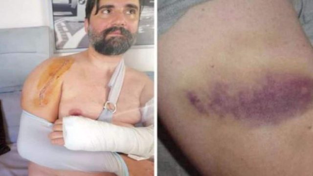 «Λεπτή η γραμμή μεταξύ ζωής και θανάτου» – Σοκάρουν οι φωτογραφίες από τον ξυλοδαρμό διασώστη του ΕΚΑΒ