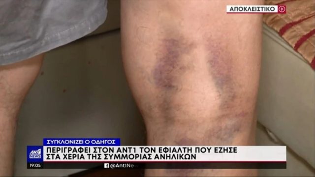 Συναγερμός στο Μενίδι: Συμμορία ανηλίκων ξυλοκόπησε οδηγό ταξί – Επί δέκα λεπτά τέσσερα άτομα τον χτυπούσαν (Video)