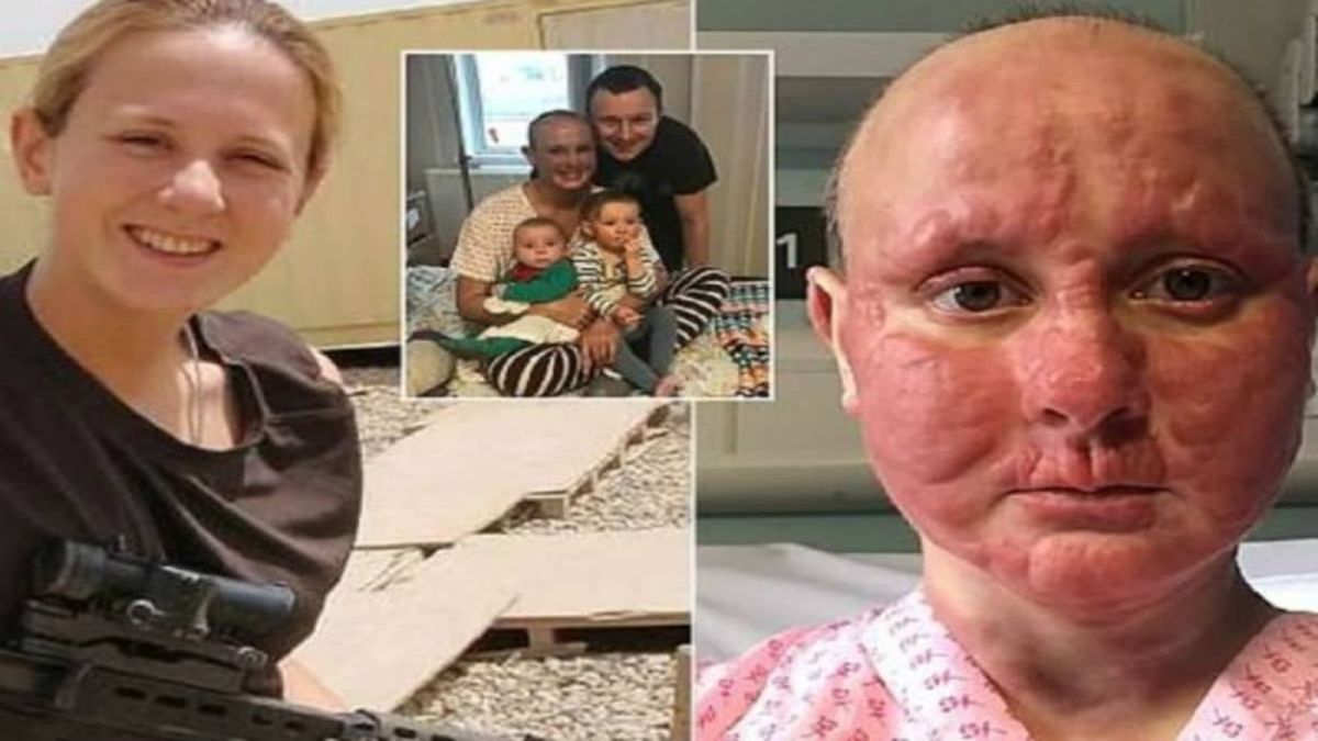 37χρονη μητέρα με καρκίνο τελικού σταδίου δεν θέλει να δεθεί με τα μωρά της… Μια συγκλονιστική ιστορία