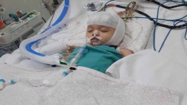 Μωρό έπεσε σε κώμα – Το ξέχασε η νταντά στην μπανιέρα!