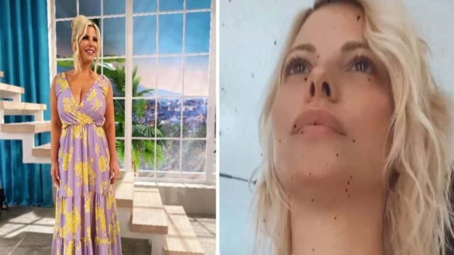 Μια άλλη γυναίκα πλέον η Αντελίνα Βαρθακούρη: Με γκρίζες τρίχες στα μαλλιά, χωρίς εξτέ και αδυνατισμένη φουλ!