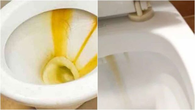 Καθαριστικό “θαύμα”: Το σπιτικό μείγμα 4 υλικών που θα εξαφανίσει το πουρί από τη λεκάνη στη στιγμή