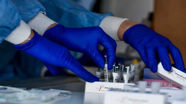 Κορωνοϊός: Γι’ αυτόν τον λόγο δε θα ανακοινωθούν τα κρούσματα σήμερα (11/7) – Διευκρινίσεις από τον ΕΟΔΥ
