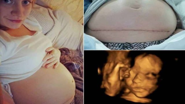 Δεν είναι μια συνηθισμένη γέννα – Μόλις αυτή έγινε το μωρό…