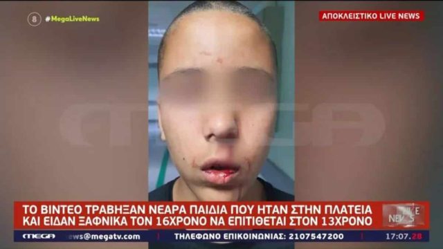 Κηφισιά: Σοκάρει ο άγριος ξυλοδαρμός 13χρονου από 16χρονο – «Τον χτύπαγε στη σπονδυλική στήλη με δυνατές κλωτσιές»