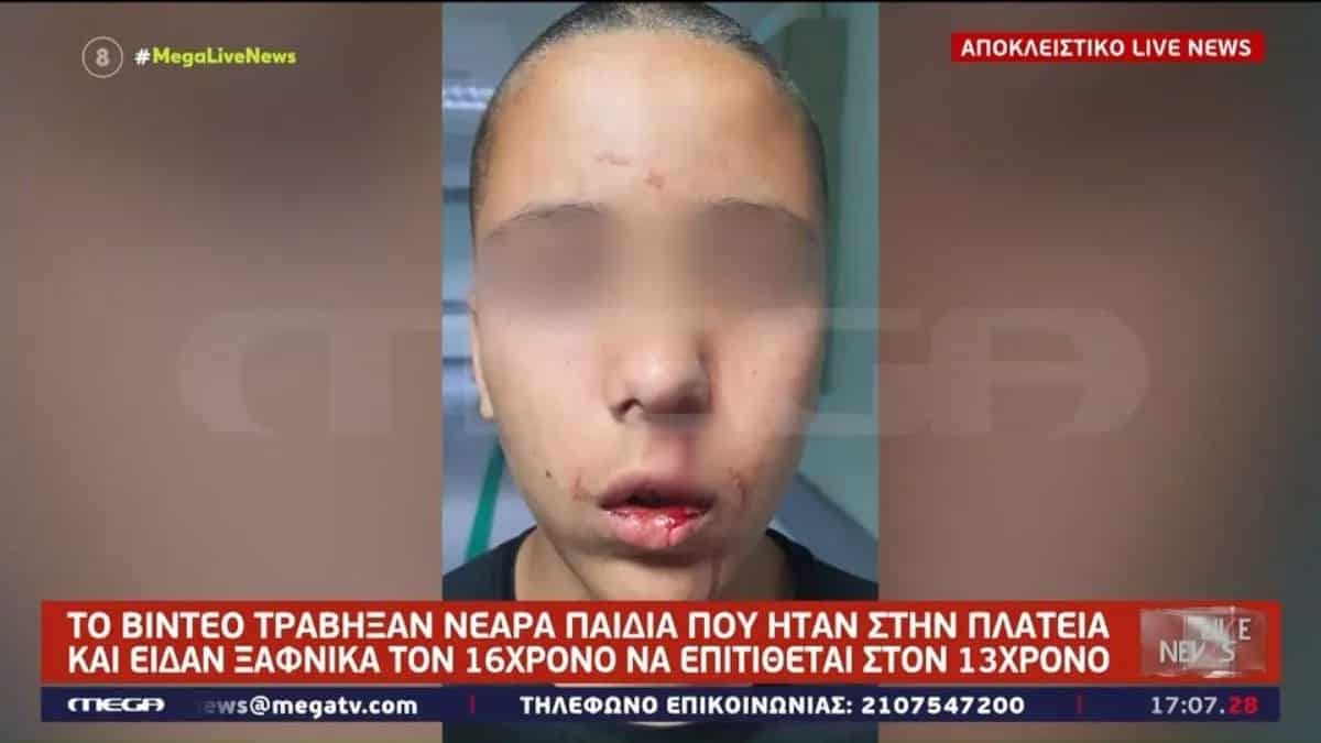 Κηφισιά: Σοκάρει ο άγριος ξυλοδαρμός 13χρονου από 16χρονο – «Τον χτύπαγε στη σπονδυλική στήλη με δυνατές κλωτσιές»