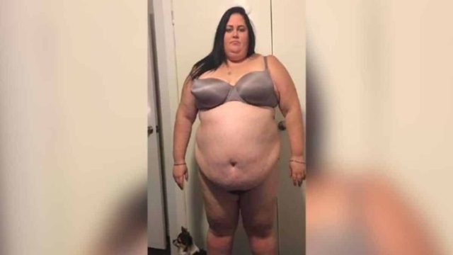 Ζύγιζε 183 κιλά και οι γιατροί δεν της έδιναν ελπίδα ζωής! Της είπαν ότι θα πέθαινε πριν τα 40 αλλά…έγινε κάτι απρόσμενο!