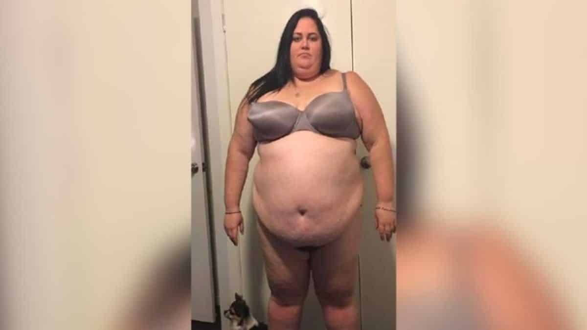Ζύγιζε 183 κιλά και οι γιατροί δεν της έδιναν ελπίδα ζωής! Της είπαν ότι θα πέθαινε πριν τα 40 αλλά…έγινε κάτι απρόσμενο!