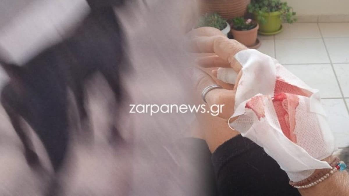 Χανιά: Σκύλος επιτέθηκε σε γυναίκα! «Είχα τρομάξει, έτρεχαν αίματα παντού…. Δεν είχα την δύναμή του για να αντισταθώ» – Σοκάρει η ανατριχιαστική περιγραφή της