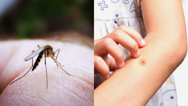 Απαλλαγείτε από τα κουνούπια με αυτά τα φυτά “ασπίδα” και πείτε αντίο στα τσιμπήματα