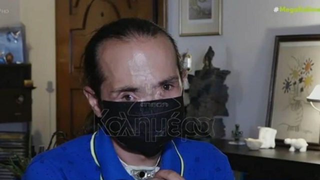Συγκλονίζει ο Θύμιος Μπουγάς: “Οι γιατροί έφυγαν, είπαν ότι θα με πάρουν τηλέφωνο, αλλά δεν πήραν” (video)