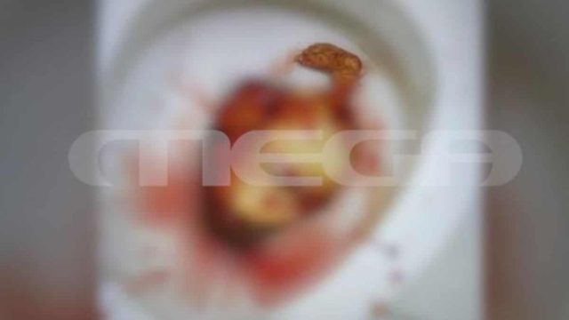 “Το παιδί ήθελε να ζήσει…” – Ανατριχιάζει αυτόπτης μάρτυρας για την έγκυο που γέννησε μέσα σε λεκάνη (Video)