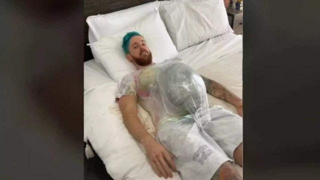 Το αποτυχημένο πείραμα ενός άνδρα γίνεται viral και διχάζει την κοινή γνώμη – Πώς είναι να είσαι έγκυος για μια μέρα;