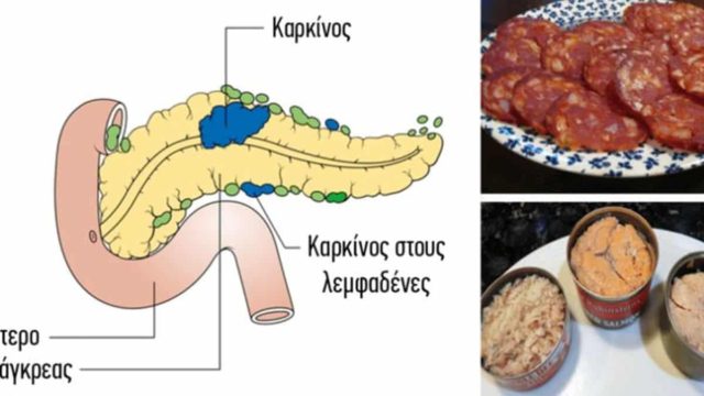 14 Τροφές που έχουν αποδειχθεί ότι προκαλούν καρκίνο δεν πρέπει να ξαναβάλετε στο στόμα σας