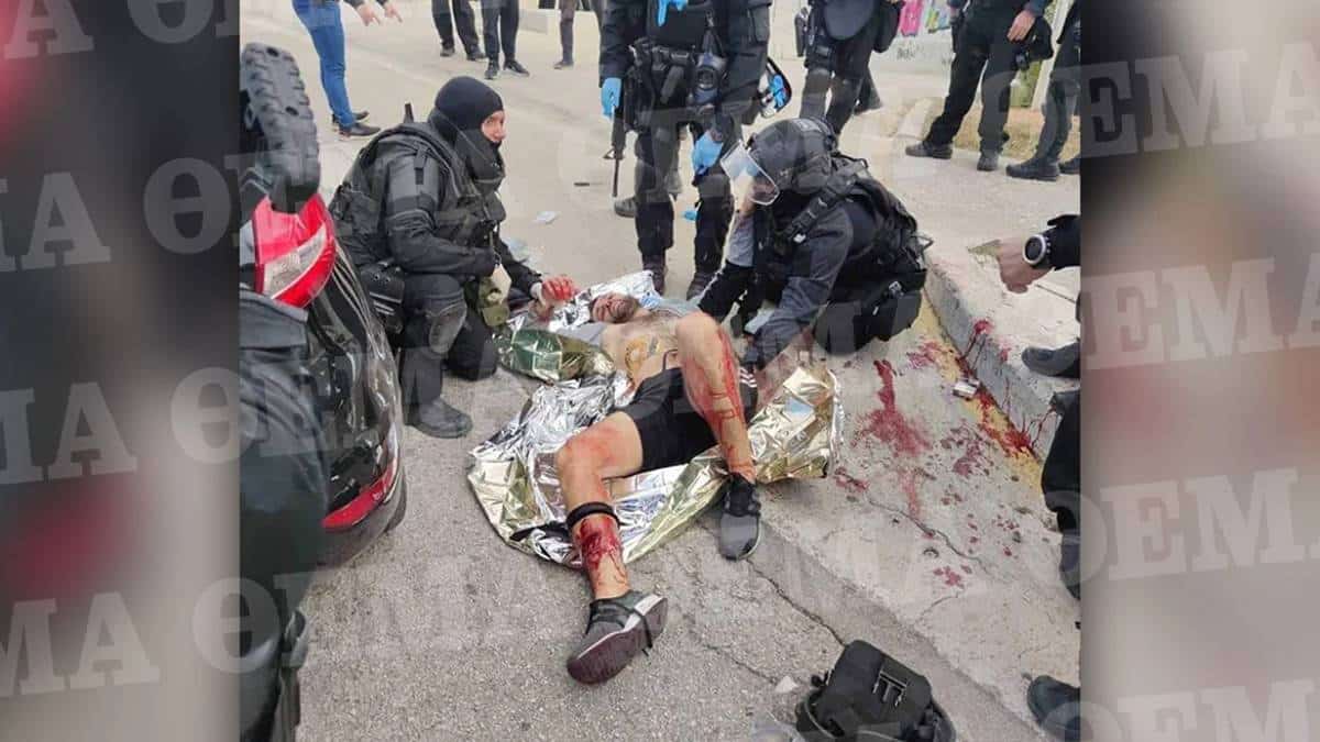 Πολυτεχνειούπολη Ζωγράφου: Ο Αλβανός κακοποιός δέχεται τις πρώτες βοήθειες από τους άνδρες των ΕΚΑΜ – Φωτογραφία-ντοκουμέντο