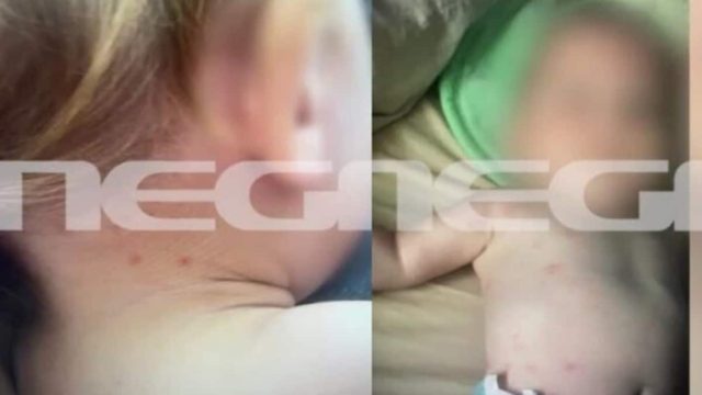 Έγκλημα στην Καβάλα – Αποτροπιαστικό ντοκουμέντο: Εικόνες-σοκ με σημαδεμένο το κορμάκι του μωρού από τα τσιμπήματα ψύλλων (video)