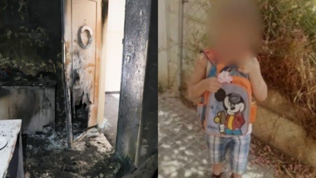 Κολωνός: Πέθανε μετά από 12 μέρες ο 5χρονος από τη φωτιά σε διαμέρισμα