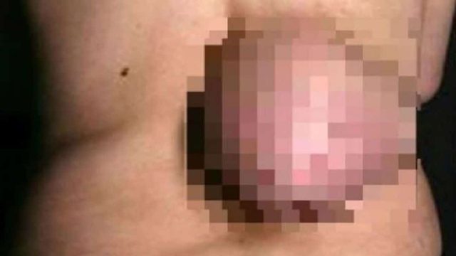“Πάγωσε” ο γιατρός μόλις είδε τι είχε στην πλάτη της η ασθενής! Δεν το είχε ξαναδεί ποτέ (photos)