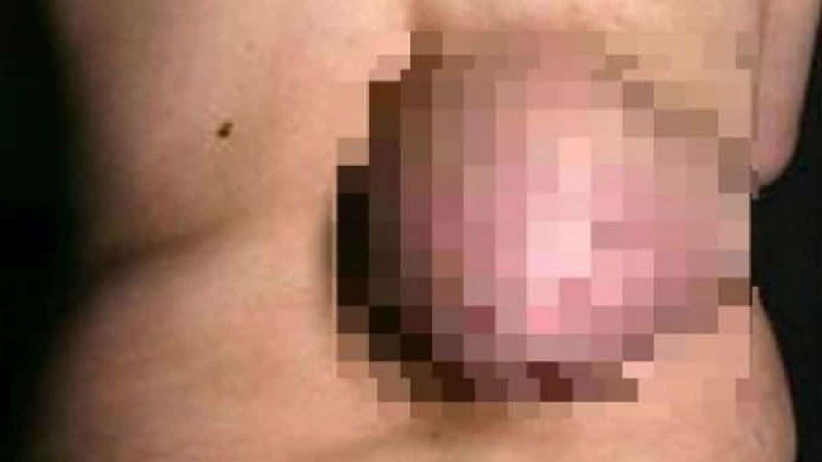“Πάγωσε” ο γιατρός μόλις είδε τι είχε στην πλάτη της η ασθενής! Δεν το είχε ξαναδεί ποτέ (photos)