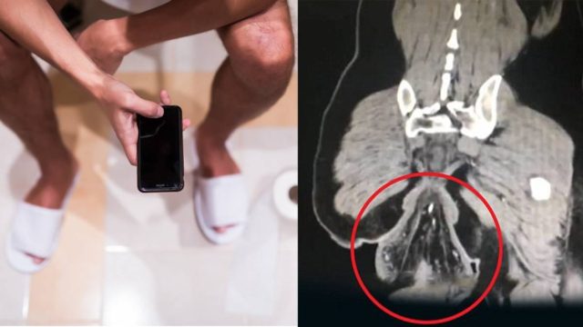 Κι όμως συνέβη: Κάθισε σε λεκάνη τουαλέτας για 5 μέρες για να σπάσει… ανύπαρκτο ρεκόρ