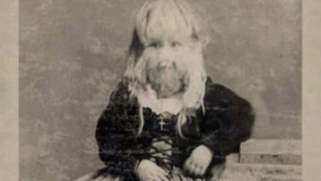Όταν ήταν 5 χρονών οι τρίχες στο πρόσωπό της όλο και μεγάλωναν…Αυτό που της έκαναν οι γονείς της ξεπερνά κάθε φαντασία!