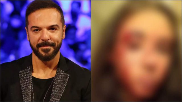 Τραγικές ώρες για τον Τριαντάφυλλο: Θύμα άγριου ξυλοδαρμού η βαφτιστήρα του – Σοκαριστικές φωτογραφίες