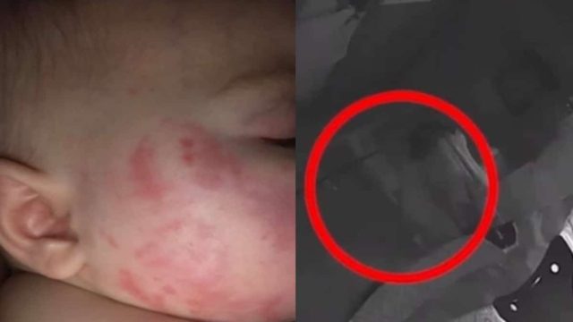 Το μωρό ξυπνούσε γεμάτο μώλωπες και γρατζουνιές – Όταν οι γονείς έβαλαν κρυφή κάμερα ανακάλυψαν κάτι τρομακτικό