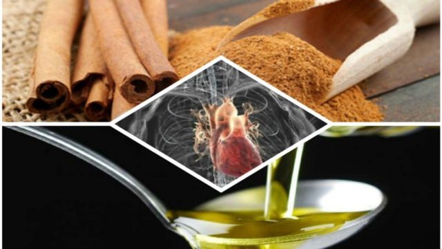 Ελαιόλαδο, κανέλα και άλλες 5 τροφές που ξεβουλώνουν τις αρτηρίες – Προσοχή