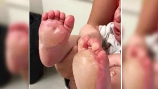 Γύρισε σπίτι και βρήκε τις πατούσες του μωρού της πρησμένες σαν μπάλες – Όταν κατάλαβε τι είχε συμβεί, της σηκώθηκε η τρίχα…