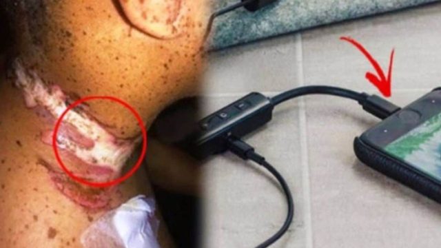 Έβαλε το κινητό του να φορτίζει και έπεσε για ύπνο – Μόλις δείτε τι του συνέβη θα πάθετε σοκ!