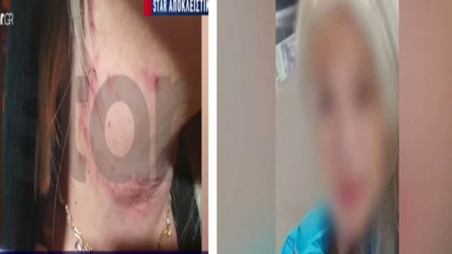 Θρίλερ στη Δραπετσώνα: «Πήρε το μαχαίρι, με τράβηξε από τα μαλλιά και πήγε να μου κόψει τον λαιμό!» – Συγκλονίζει η 45χρονη γυναίκα που έπεσε θύμα κακοποίησης από τον εν διαστάσει σύζυγό της