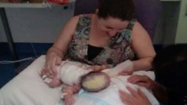 Στη γέννα παρατήρησαν κάτι πολύ παράξενο στο κεφάλι του μωρού – Μόλις κατάλαβαν τι ήταν, τους κόπηκε η ανάσα!