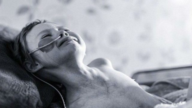 31χρονος ανέβασε αυτή τη φωτογραφία της 4χρονης κόρης του για να δείξει το πρόσωπο του καρκίνου – Η αντίδραση του κόσμου; Θα σας συγκλονίσει