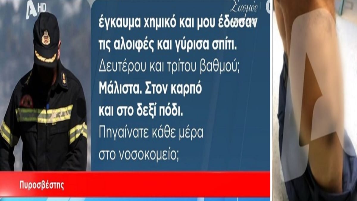 Τραγωδία στα Τέμπη: «Οργιάζουν» οι θεωρίες συνωμοσίας για τα εγκαύματα των πυροσβεστών! Οι πρώτες εκτιμήσεις των ειδικών και οι μαρτυρίες – Φωτογραφίες που σοκάρουν (Video)