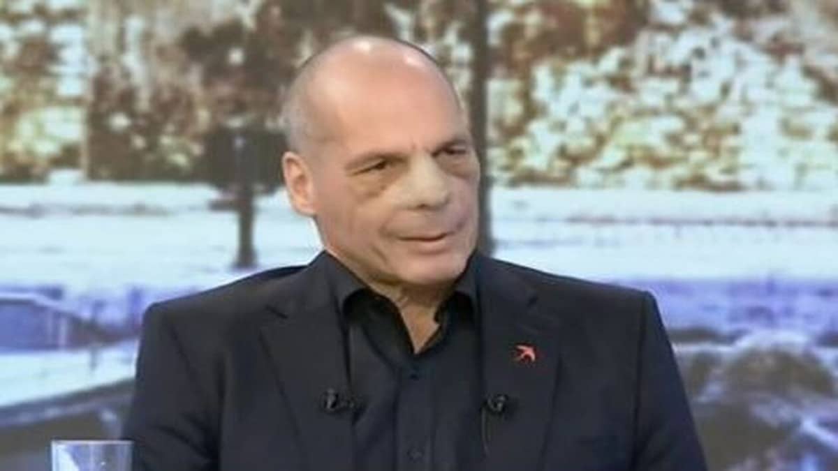 Σπασμένη μύτη, πρησμένα ζυγωματικά… Πρώτη εμφάνιση του Γιάνη Βαρουφάκη με τα σημάδια του ξυλοδαρμού – «Θα αλλάξουν τα πράγματα…»