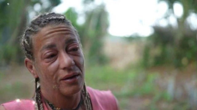 Survivor All Star 10/04 highlights: Παραμορφώθηκε εντελώς το πρόσωπο της Αφροδίτης Σκαφίδα! Άρον άρον με ασθενοφόρο στο νοσοκομείο