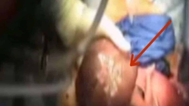 Έγκυος πήγε στο γιατρό για να μάθει το φύλο του μωρού – Οι γιατροί “πάγωσαν” με αυτό που είδαν