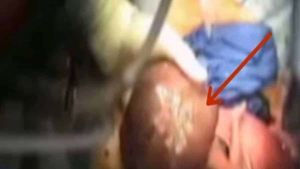 Έγκυος πήγε στο γιατρό για να μάθει το φύλο του μωρού – Οι γιατροί “πάγωσαν” με αυτό που είδαν