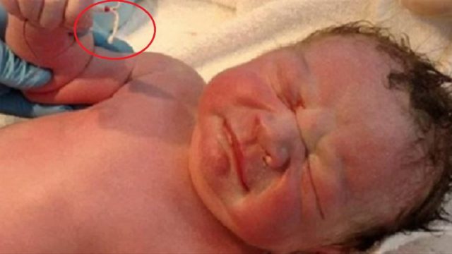 Αυτό το μωράκι μόλις γεννήθηκε – Για προσέξτε όμως τι κρατάει στο χεράκι του… Θα μείνετε άφωνοι