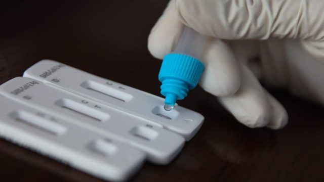Νέος συναγερμός από τον ΕΟΦ – Ανακαλεί άμεσα rapid test για κορωνοϊό και γρίπη