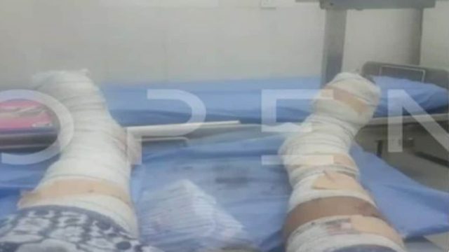Σουδάν: Φωτογραφία ντοκουμέντο από τα τραύματα του Έλληνα τραυματία – «Ελπίζουμε σε ένα θαύμα» (Video)