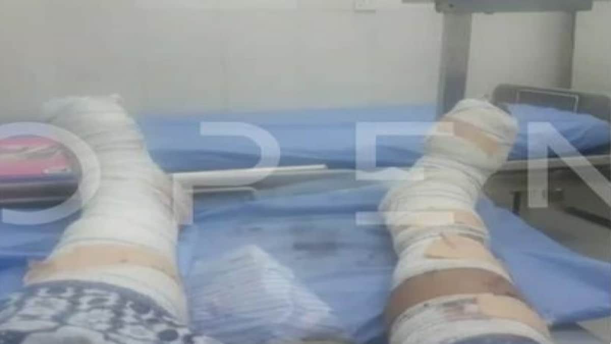 Σουδάν: Φωτογραφία ντοκουμέντο από τα τραύματα του Έλληνα τραυματία – «Ελπίζουμε σε ένα θαύμα» (Video)