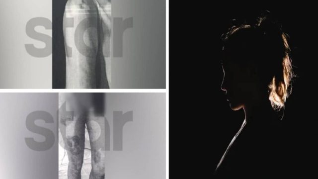 Βιασμός 27χρονης στη Μύκονο: «Οι αστυνομικοί προσπάθησαν να την αποτρέψουν να καταθέσει μήνυση» – Καταγγελιες “φωτιά” από τον δικηγόρο της κοπέλας (Video)