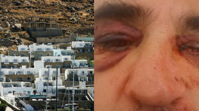 Μύκονος: Ανοίγουν στόματα για την υπόθεση ξυλοδαρμού αρχαιολόγου – Κοντά στους δράστες η ΕΛ.ΑΣ