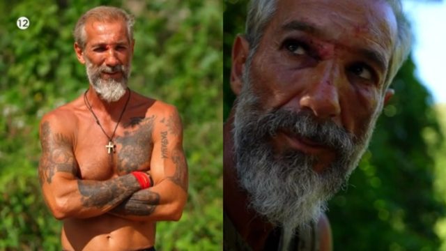 Survivor All Star: «Σαν μούμια είναι…» – Ο Τάκης τραυματίστηκε στο πρόσωπο και το Twitter τον «γλέντησε» για την νέα «εικόνα»