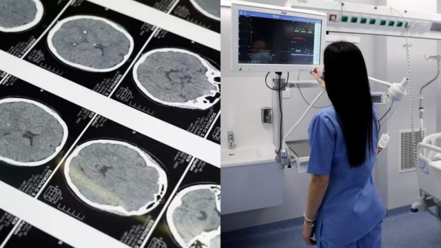 Παγκόσμιος συναγερμός: Ανησυχία ειδικών για μπαράζ κρουσμάτων εγκεφαλικών αποστημάτων σε παιδιά – Άγνωστο αν φταίει η πανδημία