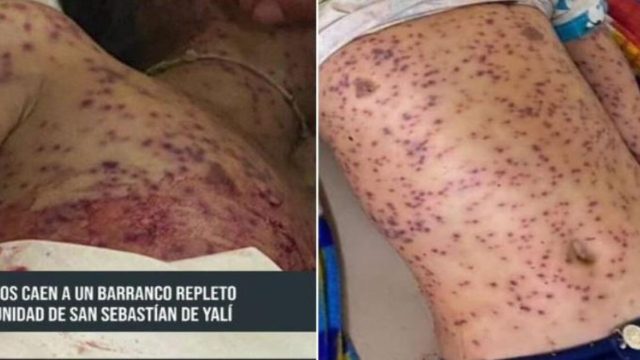 Φρικτές εικόνες: 6 νεκροί από τσιμπήματα όταν λεωφορείο έπεσε σε φαράγγι με μελίσσια! (video)