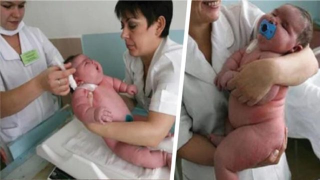 Έγκυος γέννησε μωρό… 18 κιλών! Δεν θα πιστεύετε πόσο ζυγίζει η μαμά του!